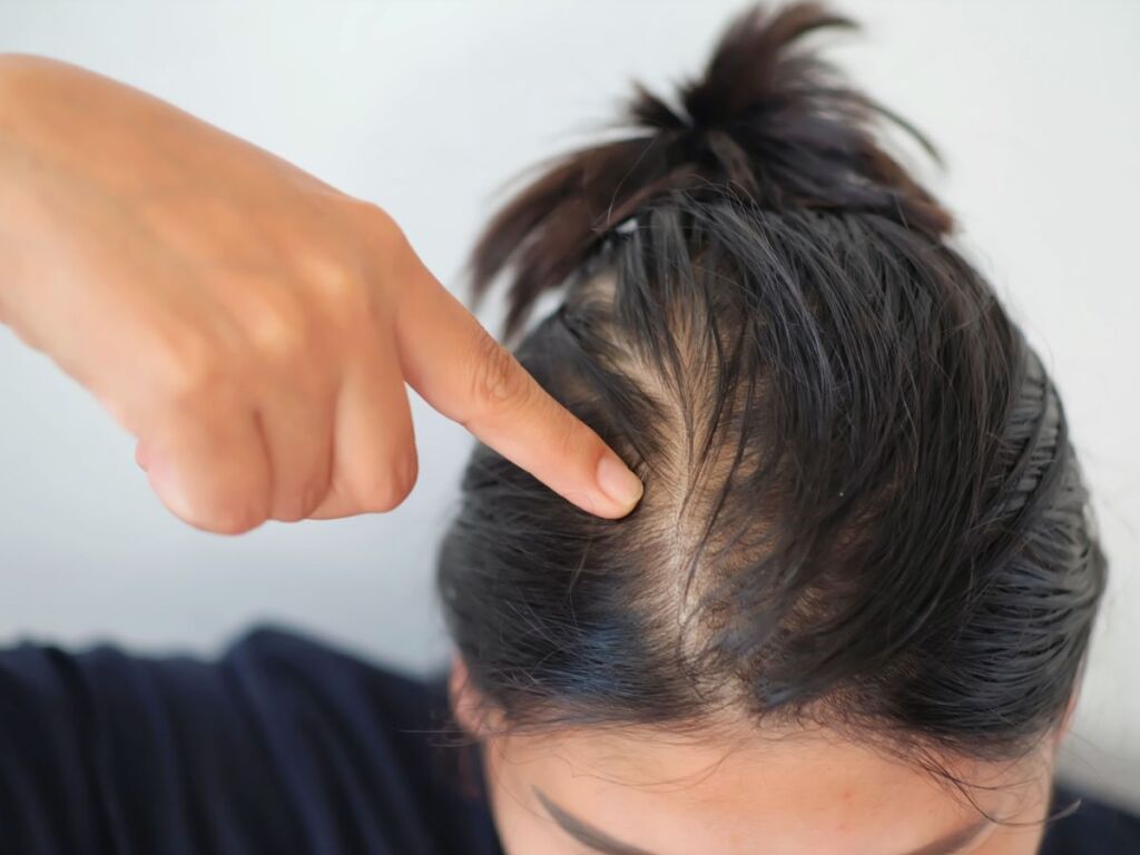 Natural Ways to Regrow Thinning Hair