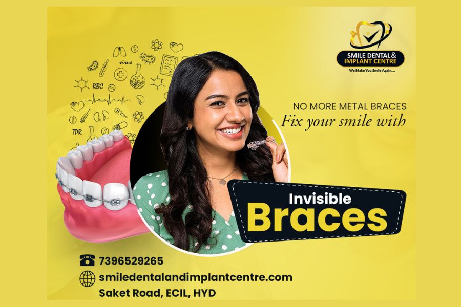 Smile Dental and Implant Centre shared the benefits of Invisible Braces over the Traditional Braces Treatment in a recently held Press Conference